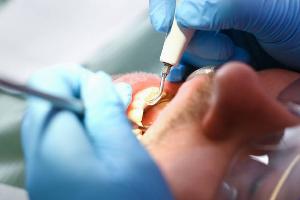 Best Emergency Treatment for Toothache in Groves, TX