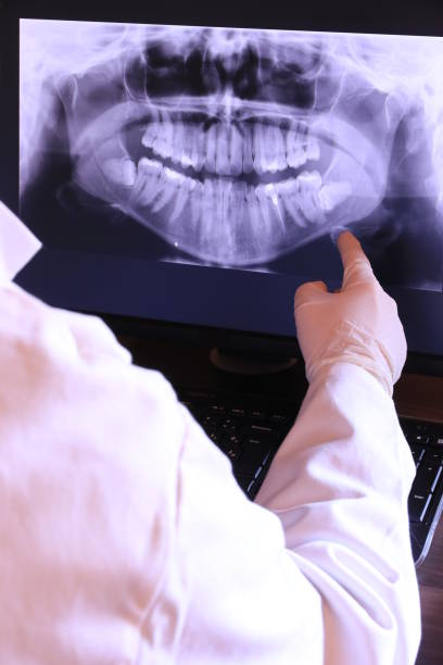 Best Emergency Root Canal Treatment in Groves, TX